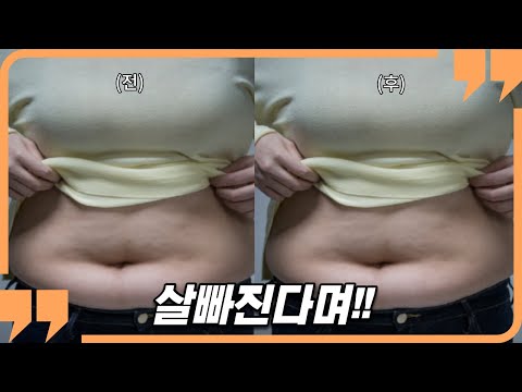 지방 흡입 수술 하시는 분들 ,이거 안 보면 진짜 큰일납니다