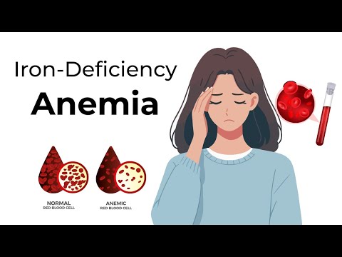 Iron Deficiency Anemia: Symptoms and Causes