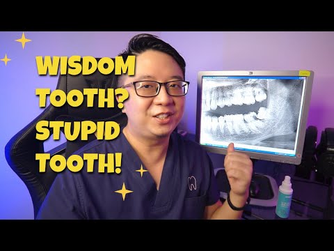 Reasons to remove wisdom tooth