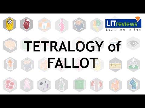 Tetralogy of Fallot - Duke University