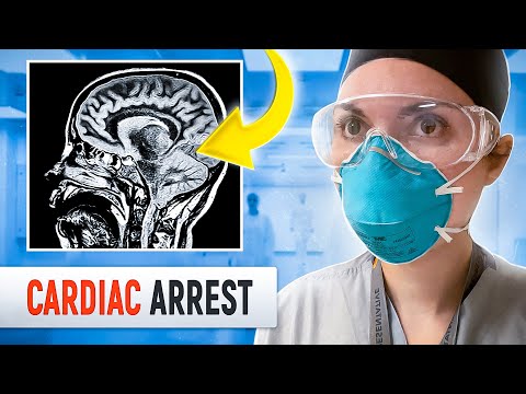 ICU NIGHT SHIFT: Day in the Life of a DOCTOR (Cardiac Arrest Cooling Protocol)