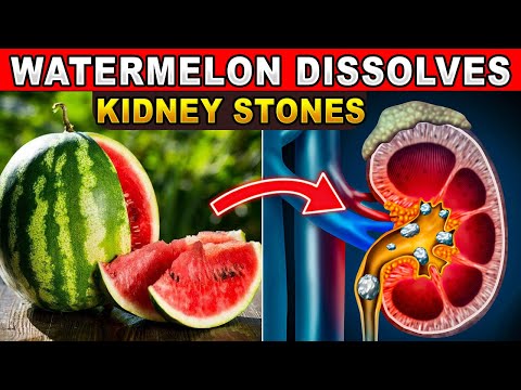 Top 3 Fruits That Detoxed Hundreds of Kidneys and Prevented Dialysis | Healthy lifestyle