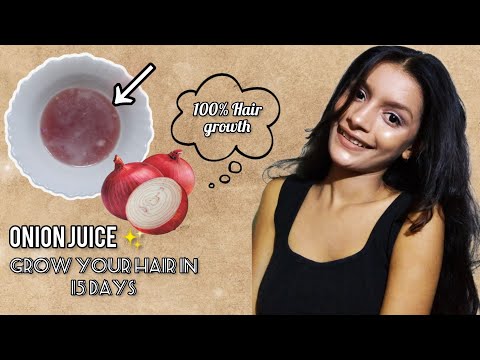 How to use Onion juice for extreme hairfall/hairloss/Dandruff|Get long, shiny hair in just 15 days