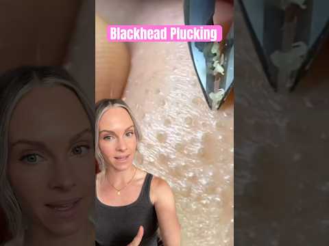 MOST SATISFYING BLACKHEAD PLUCKING REMOVAL #shorts