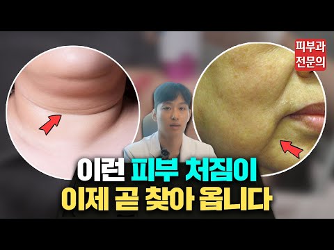 피부과 전문의가 알려주는 피부 탄력 관리(울쎄라) 200% 효과 보는 방법