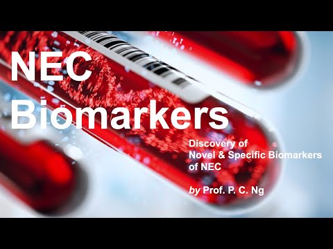 Discovery of Novel & Specific NEC Biomarkers - Prof. P. C. Ng