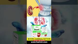 Best Treatment For Kidney Stone Problems #health #explore #facts #viral #shorts