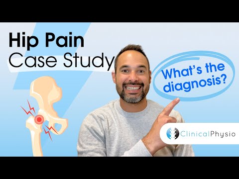 Hip Pain Case Study | Expert Physio Guides You Through Hip Assessment and Diagnosis!