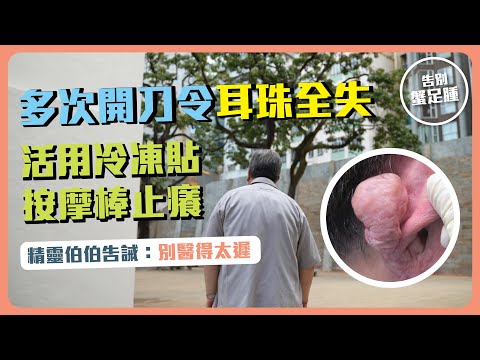 【告別蟹足腫】EP3 多次開刀令耳珠全失｜活用冷凍貼按摩棒止癢｜精靈伯伯告誡：別醫得太遲