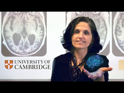 AI that predicts progress of Alzheimer's disease