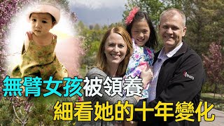 美國夫婦收養中國無臂女孩，十年過去，她用腳舞出精彩人生！#第五情報站