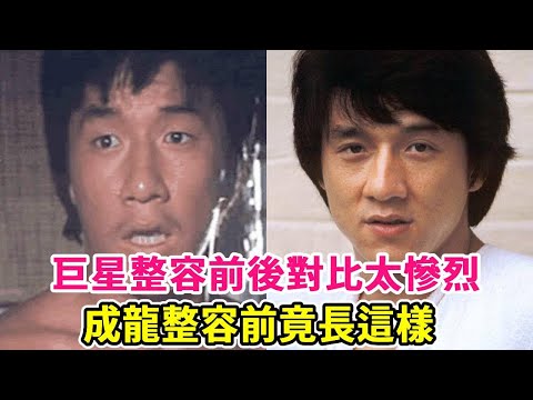 TVB superstar before and after plastic surgery! The contrast between these six before and after is