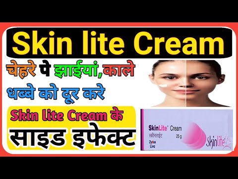 Skin lite Cream के side effect देखने के बाद हर कोई इस क्रीम को लगाएगा l Side effects of skin lite