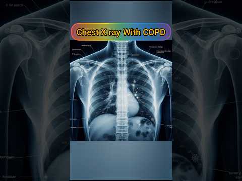 COPD in Lungs