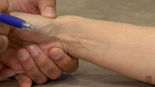 Mayo Clinic Minute: Reducing thumb arthritis pain