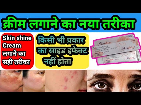 skin shine Cream लगाने का नया तरीका, how to apply skin shine cream #cngajbhiye