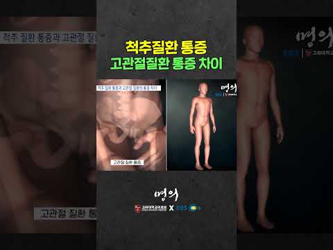 척추질환 통증 vs 고관절질환 통증