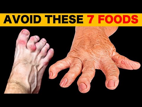 7 Foods To Avoid If You Have Arthritis