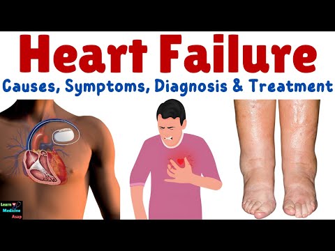 Heart Failure (HF) – Causes, Symptoms, Stages, Diagnosis and Management