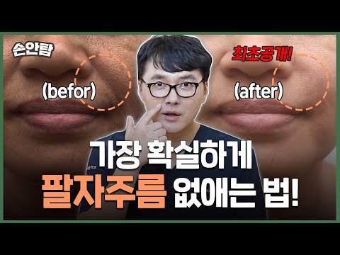 팔자주름 없애기! 가장 확실한 방법💉 "국내 유일 팔자000으로 단번에 없애드립니다!" #시술추천 ㅣ 모즈의원 - 손원장