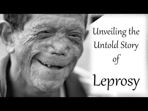 "Unveiling the Untold Story of Leprosy: A Journey Through History"