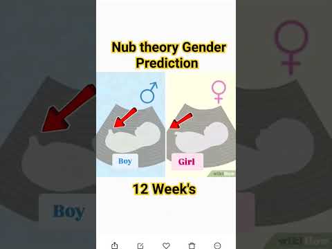 12 Week's Nub theory Gender Reveal ultrasound scan