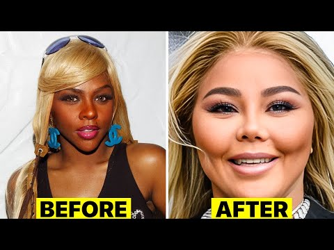 Top 10 Celebrities Who Destroyed Their Face | Plastic Surgeon Reacts