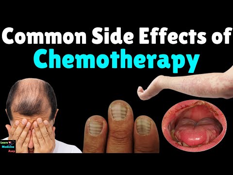 Chemotherapy Side Effects | Side Effects of Chemotherapy – Symptoms & Management