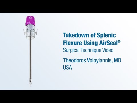 Dr. Theodoros Voloyiannis - Takedown of Splenic Flexure Using AirSeal® - CONMED Surgical Technique