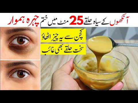 Remove Dark Circles In 20 Minutes || How To Remove Dark Circles || Effective Dark Circle Remedy