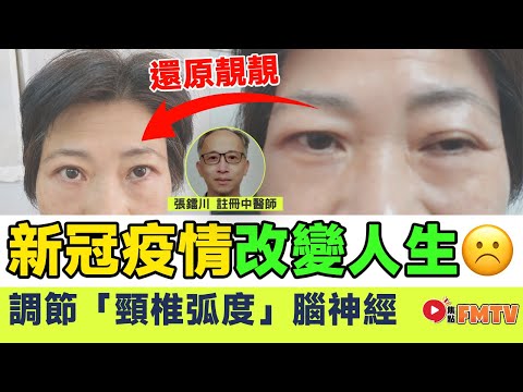 一個新冠疫情徹底改變人生，面歪、面癱、大細眼 竟是腦神經問題所致？ 調節「頸椎弧度」DIY！ 《#明德堂︱EP 5》 張鐳川 中醫 痛症 養生 保健 物理治療 腦神經︱FMTV