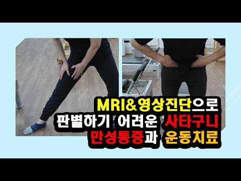 서혜부 만성통증 이렇게 운동하세요