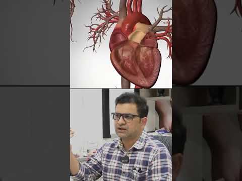 Dr. Movva Srinivas on Bypass Surgery #health #doctor #motivation #inspiration #health #education