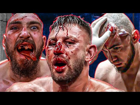 Don't Watch With A Weak Stomach 😳 (BARE KNUCKLE)