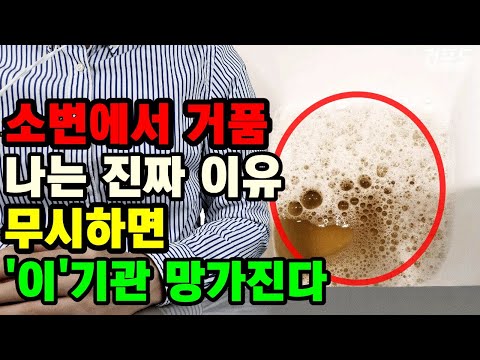 소변에 거품이 나는 진짜 이유. 무시하면 큰일나는 요단백 원인 증상