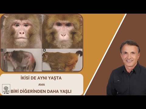 İkisi De Aynı Yaşta Ama Biri Daha Yaşlı