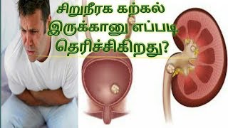 சிறுநீரக கல் இருக்கானு தெரிஞ்சுக்கறது எப்படி? kidney stone in Tamil