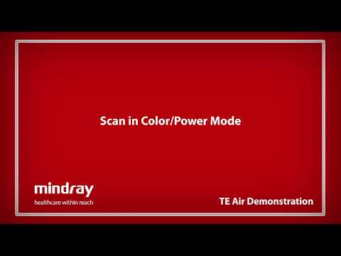 Mindray TE Air Tutorial - Scan in Color Power Mode