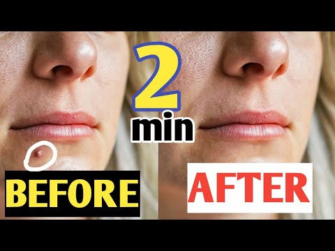 how to remove pimples mark in 2 minutes in kannada | photo editing in kannada photoshop 2020