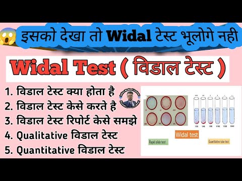 Widal Test Practical in hindi | Qualitative Widal Test | Quantitative Widal Test | Typhoid Test