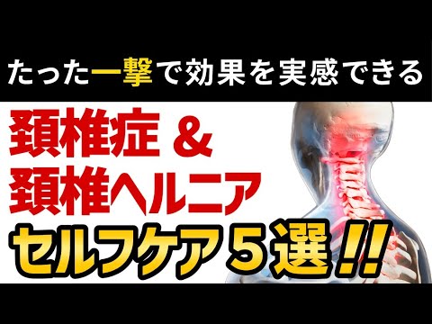 【一撃で効果出る】頚椎症・頚椎ヘルニアのセルフケア５STEP