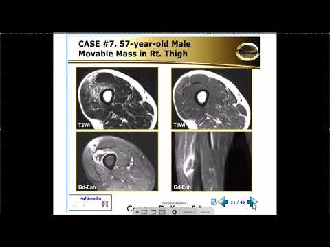 MRI of the Muscles Lectures | Part 2