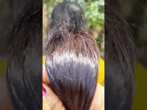 🔥Ginger and Nigella hair tonic for thick hair | #shorts #haircare #youtubeshorts #trending #short