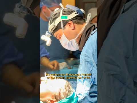 Behind the Scenes: A Day of Pentalift Surgery with Assoc. Prof. Dr. Güncel Öztürk