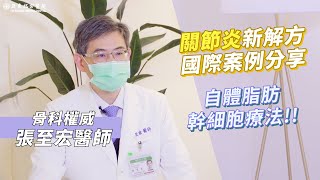 治療關節炎新方法!! 自體脂幹細胞療法解決你的關節痛! | 亞東醫院骨科部