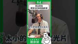 揪出肺癌，要靠低劑量電腦斷層｜康健雜誌