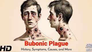 Bubonic Plague: The Black Death