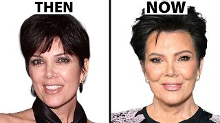 Kris Jenner's NEW FACE | Plastic Surgery Analysis