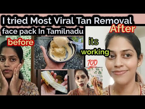 🔥🔥🔥இரண்டு நாள் தேய்த்தேன் எனக்கு நல்ல மாற்றம் / Most viral tips for skin tan removal in Tamilnadu