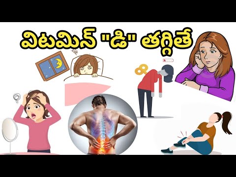 vitamin "డి"  తక్కువగా ఉంటే కనపడే లక్షణాలు,చికిత్స విధానం | Vitamin D Deficiency Symptoms in Telugu